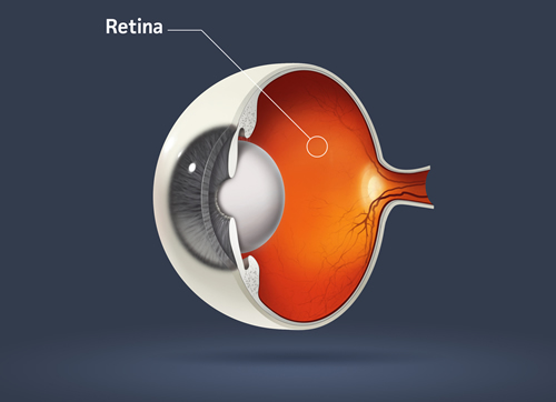 Retina Maryland | Midshore Surgical Eye Center